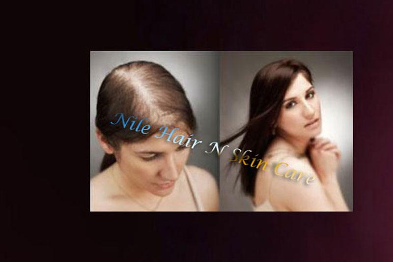 Best Hair Extension in Marathahalli, Bangalore