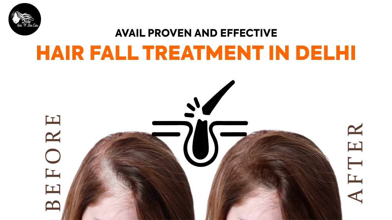 Avail Proven and Effective Hair Fall Treatment in Delhi