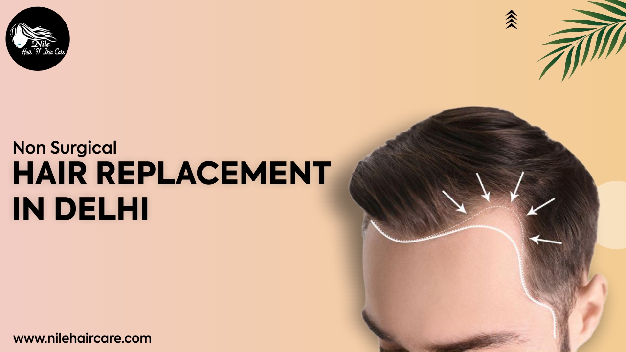 Bid Adieu to All your Hair Worries with Non-Surgical Hair Replacement in Delhi