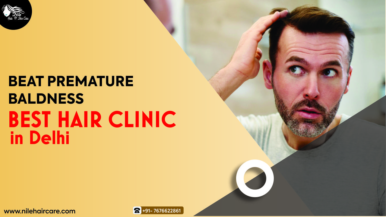 Beat Premature Baldness from the Best Hair Clinic in Delhi: Nile Hair Care