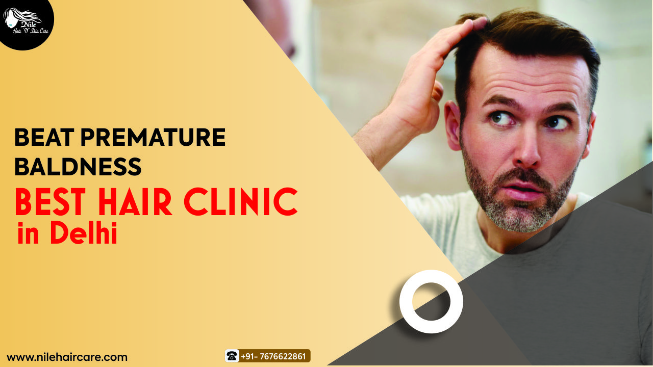 Beat Premature Baldness from the Best Hair Clinic in Delhi: Nile Hair Care Beat Premature Baldness from the Best Hair Clinic in Delhi: Nile Hair Care