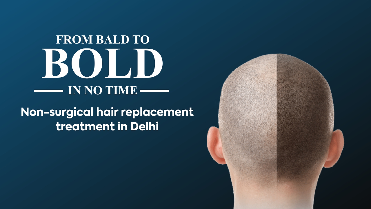 Why would you opt for non-surgical hair replacement in Delhi?