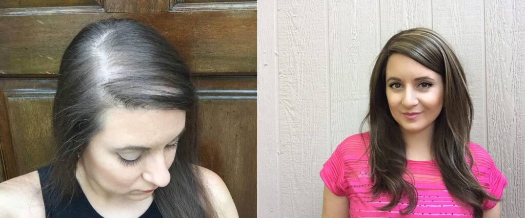 Hair Thinning in Women After 30