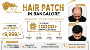 Hair fixing in Koramangala Bangalore at Nile Hair N Skin Care